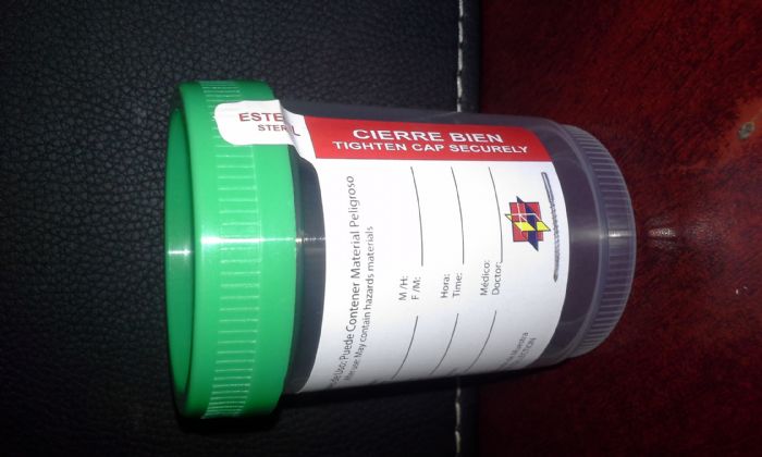 VASO RECOLECTOR DE MUESTRAS 